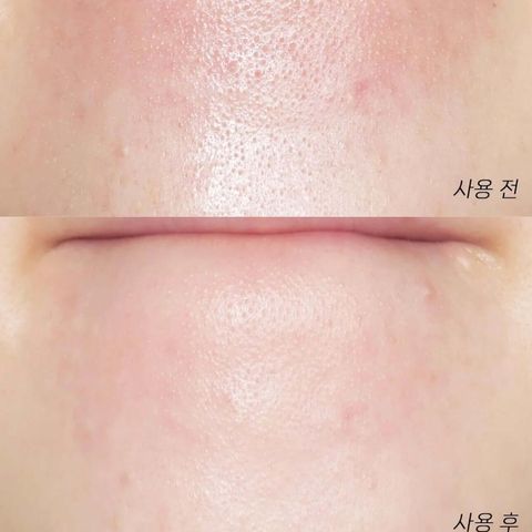 JuzBeauty-JuzBeautyMalaysia-JuzPretty-Authentic-Kbeauty-Malaysia-Skin-Care-Cosmetics-Jbeauty-Health-Care-korean-streetwear-Olive Young ILSO Super Melting Sebum Softener 黑头粉刺导出液5