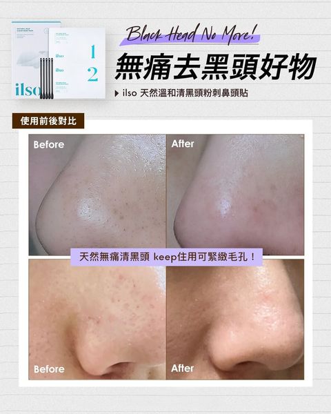 JuzBeauty-JuzBeautyMalaysia-JuzPretty-Authentic-Kbeauty-Malaysia-Skin-Care-Cosmetics-Jbeauty-Health-Care-korean-streetwear-Olive Young ILSO Natural Mild Clear Nose Pack 天然温和清黑头粉刺鼻头贴6
