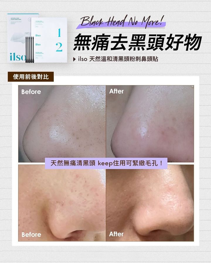JuzBeauty-JuzBeautyMalaysia-JuzPretty-Authentic-Kbeauty-Malaysia-Skin-Care-Cosmetics-Jbeauty-Health-Care-korean-streetwear-Olive Young ILSO Natural Mild Clear Nose Pack 天然温和清黑头粉刺鼻头贴6