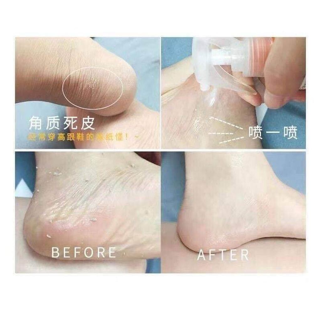 JuzBeauty-JuzBeautyMalaysia-JuzPretty-Authentic-Kbeauty-Malaysia-Skin-Care-Cosmetics-Jbeauty-Health-Care-korean-streetwear-CELLOMON Foot Peel Spray 脚部去角质喷雾水14