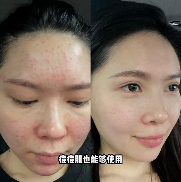 JuzBeauty-JuzBeautyMalaysia-JuzPretty-Authentic-Kbeauty-Malaysia-Skin-Care-Cosmetics-Jbeauty-Health-Care-korean-streetwear-CELAVIVE Premium Pack 终极护肤配套4