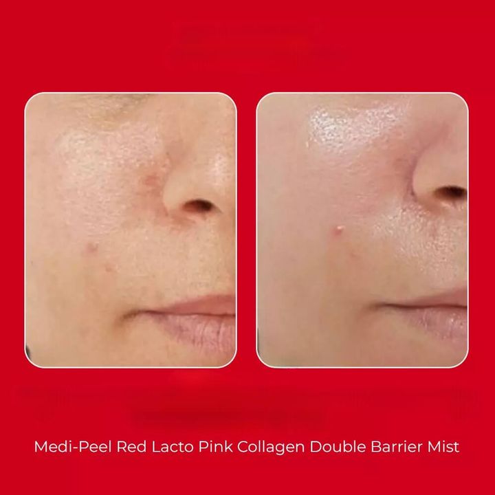JuzBeauty-JuzBeautyMalaysia-JuzPretty-Authentic-Kbeauty-Malaysia-Skin-Care-Cosmetics-Jbeauty-Health-Care-korean-streetwear-Olive-Young-MEDIPEEL Red Lacto Pink Collagen Double Barrier Mist MEDI-PEEL 粉色胶原蛋白双重屏障喷雾3