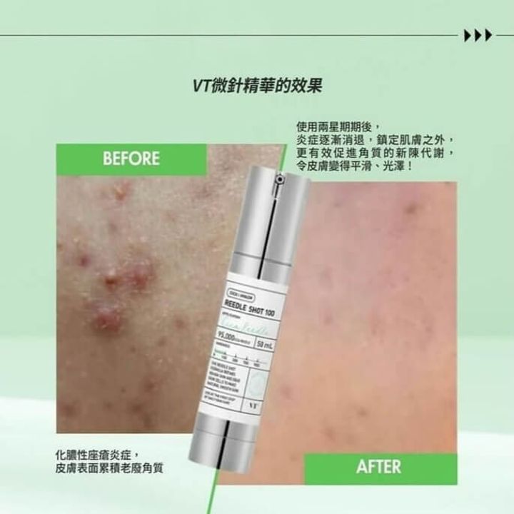 JuzBeauty-JuzBeautyMalaysia-JuzPretty-Authentic-Kbeauty-Malaysia-Skin-Care-Cosmetics-Jbeauty-Health-Care-korean-streetwear-Olive-Young-VT Reedle Shot 100 积雪草改善毛孔100微针精华3