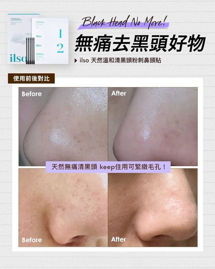 JuzBeauty-JuzBeautyMalaysia-JuzPretty-Authentic-Kbeauty-Malaysia-Skin-Care-Cosmetics-Jbeauty-Health-Care-korean-streetwear-Olive Young ILSO Natural Mild Clear Nose Pack 天然温和清黑头粉刺鼻头贴6