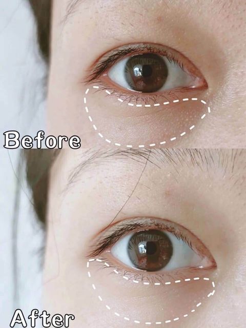 JuzBeauty_JuzBeautyMalaysia_JuzPretty_Authentic_Kbeauty_Malaysia_Skin_Care_Cosmetics_Jbeauty_Australia_Health_Care_Goodal_Green_Tangerine_Vita_C_Eye_Gel_Patch_ (7).jpg