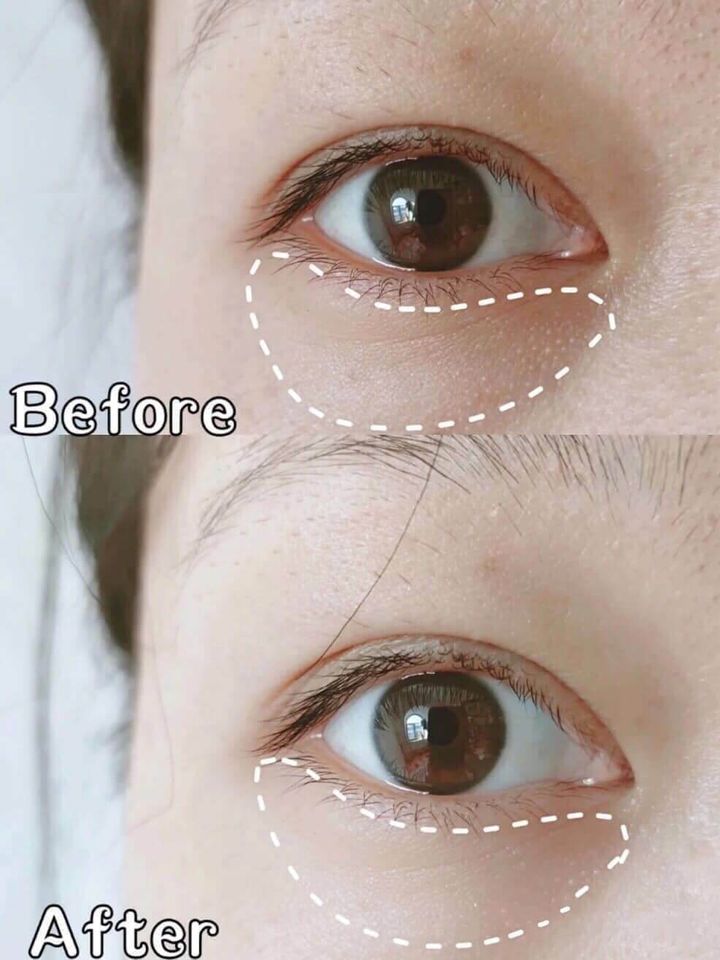 JuzBeauty_JuzBeautyMalaysia_JuzPretty_Authentic_Kbeauty_Malaysia_Skin_Care_Cosmetics_Jbeauty_Australia_Health_Care_Goodal_Green_Tangerine_Vita_C_Eye_Gel_Patch_ (7).jpg