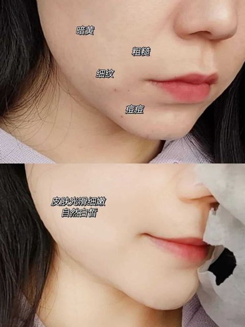 JuzBeauty-JuzBeautyMalaysia-JuzPretty-Authentic-Kbeauty-Malaysia-Skin-Care-Cosmetics-Jbeauty-Health-Care-korean-streetwear-SUDEE Mask 绷带面膜10