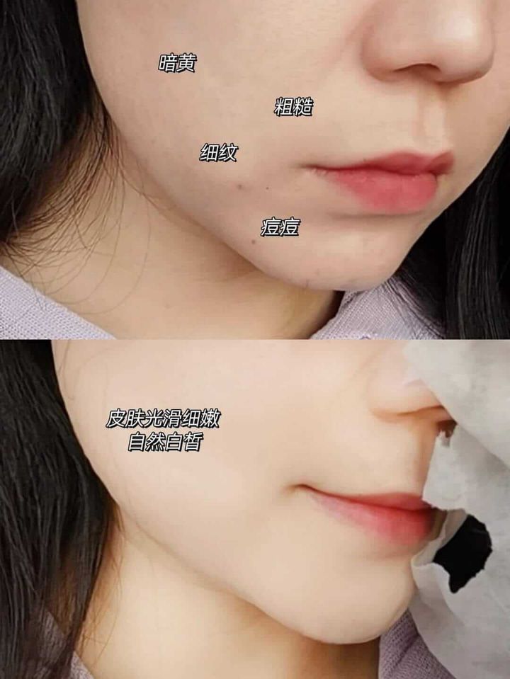 JuzBeauty-JuzBeautyMalaysia-JuzPretty-Authentic-Kbeauty-Malaysia-Skin-Care-Cosmetics-Jbeauty-Health-Care-korean-streetwear-SUDEE Mask 绷带面膜10