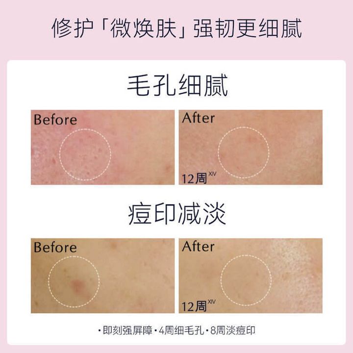 JuzBeauty-JuzBeautyMalaysia-JuzPretty-Authentic-Kbeauty-Malaysia-Skin-Care-Cosmetics-Jbeauty-Health-Care-korean-streetwear-ESTEE LAUDER Micro Essence Treatment Lotion Fresh with Sakura Ferment 樱花水 微分子肌底原生露 樱花轻盈版9
