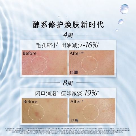 JuzBeauty-JuzBeautyMalaysia-JuzPretty-Authentic-Kbeauty-Malaysia-Skin-Care-Cosmetics-Jbeauty-Health-Care-korean-streetwear-ESTEE LAUDER Micro Essence Treatment Lotion with Bio-Ferment 原生液 微分子肌底原生露6