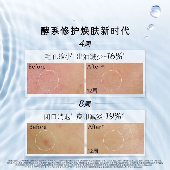 JuzBeauty-JuzBeautyMalaysia-JuzPretty-Authentic-Kbeauty-Malaysia-Skin-Care-Cosmetics-Jbeauty-Health-Care-korean-streetwear-ESTEE LAUDER Micro Essence Treatment Lotion with Bio-Ferment 原生液 微分子肌底原生露6