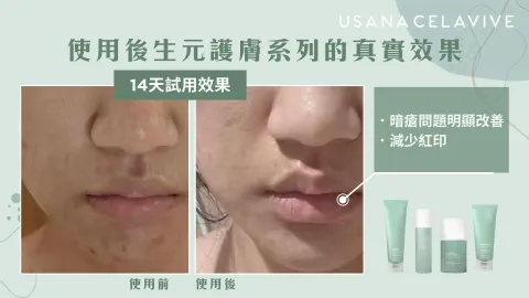 JuzBeauty-JuzBeautyMalaysia-JuzPretty-Authentic-Kbeauty-Malaysia-Skin-Care-Cosmetics-Jbeauty-Health-Care-korean-streetwear-CELAVIVE Postbiotic Calming Cleanser 后生元舒缓洁面霜3