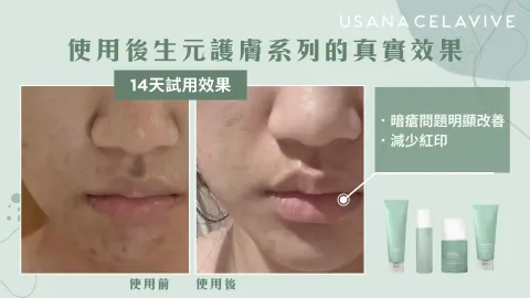 JuzBeauty-JuzBeautyMalaysia-JuzPretty-Authentic-Kbeauty-Malaysia-Skin-Care-Cosmetics-Jbeauty-Health-Care-korean-streetwear-CELAVIVE Postbiotic Calming Cleanser 后生元舒缓洁面霜3