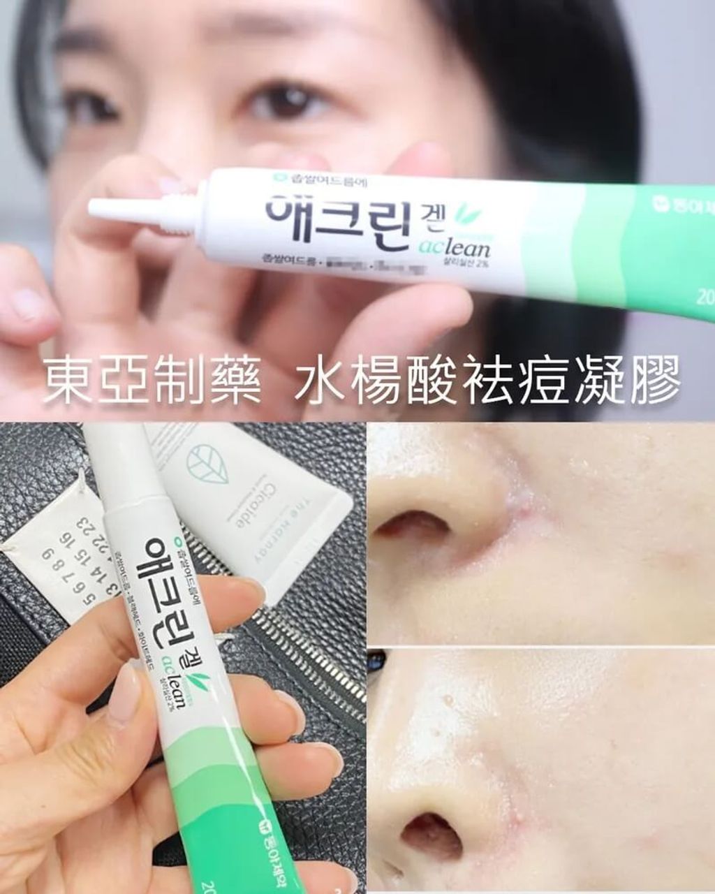 JuzBeauty-JuzBeautyMalaysia-JuzPretty-Authentic-Kbeauty-Malaysia-Skin-Care-Cosmetics-Jbeauty-Health-Care-korean-streetwear-DONG-A PHARM Aclean Gel 水杨酸凝胶11