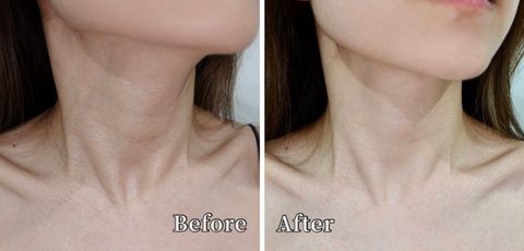 JuzBeauty-JuzBeautyMalaysia-JuzPretty-Authentic-Kbeauty-Malaysia-Skin-Care-Cosmetics-Jbeauty-Health-Care-korean-streetwear-Olive-Young-MEDITHERAPY Wrinkle-fit Neck Mask 提拉网眼颈膜3