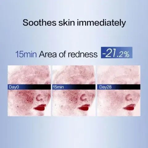 JuzBeauty-JuzBeautyMalaysia-JuzPretty-Authentic-Kbeauty-Malaysia-Skin-Care-Cosmetics-Jbeauty-Health-Care-korean-streetwear-PROYA Advanced Original Repair Concentrating Mask 源力面膜6