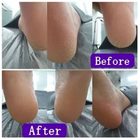JuzBeauty-JuzBeautyMalaysia-JuzPretty-Authentic-Kbeauty-Malaysia-Skin-Care-Cosmetics-Jbeauty-Health-Care-korean-streetwear-MJCARE Foot Care Pack MJ CARE 蜗牛密集修护足膜1