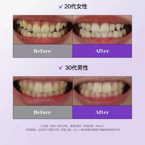 JuzBeauty-JuzBeautyMalaysia-JuzPretty-Authentic-Kbeauty-Malaysia-Skin-Care-Cosmetics-Jbeauty-Health-Care-korean-streetwear-Olive-Young-EUTHYMOL Whitening Purple Corrector Set 美白矫正牙膏套盒8