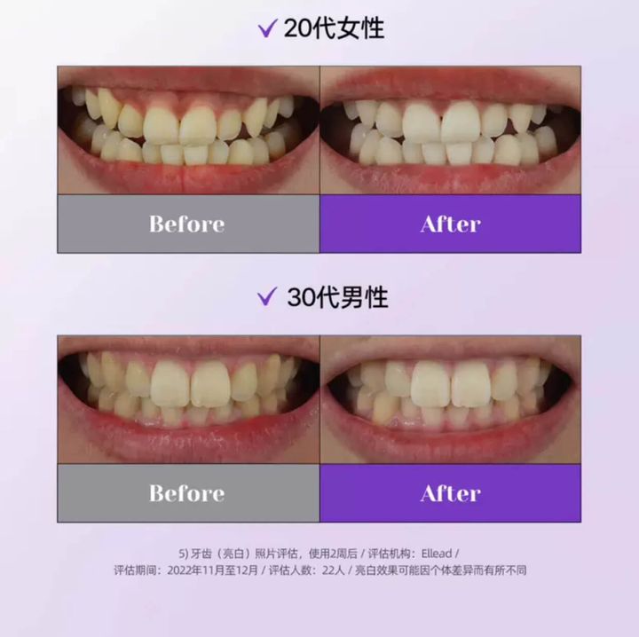 JuzBeauty-JuzBeautyMalaysia-JuzPretty-Authentic-Kbeauty-Malaysia-Skin-Care-Cosmetics-Jbeauty-Health-Care-korean-streetwear-Olive-Young-EUTHYMOL Whitening Purple Corrector Set 美白矫正牙膏套盒8