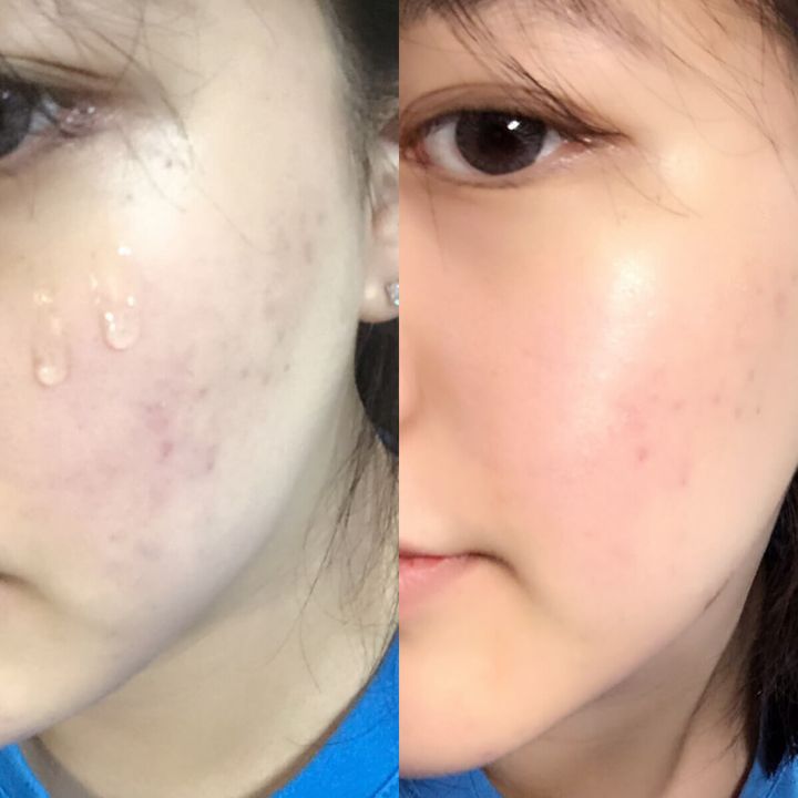 JuzBeauty_JuzBeautyMalaysia_JuzPretty_Authentic_Kbeauty_Malaysia_Jbeauty_Australia_Health_Care_CNP_Laboratory_Propolis_Energy_Ampule_ (16).jpg