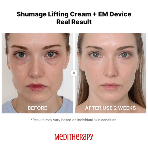 JuzBeauty-JuzBeautyMalaysia-JuzPretty-Authentic-Kbeauty-Malaysia-Skin-Care-Cosmetics-Jbeauty-Health-Care-korean-streetwear-Olive-Young-MEDITHERAPY Shumage Gold Seal Lifting Cream + EM Device 金丝紧致拉提乳霜 + 金丝抗老EMS紧致美容仪12