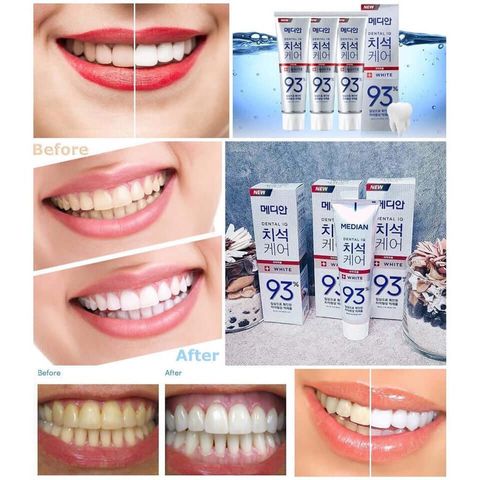 JuzBeauty-JuzBeautyMalaysia-JuzPretty-Authentic-Kbeauty-Malaysia-Skin-Care-Cosmetics-Jbeauty-Health-Care-korean-streetwear-Olive-Young-MEDIAN Dental IQ 93% Toothpaste 93 去牙结石美白牙膏18