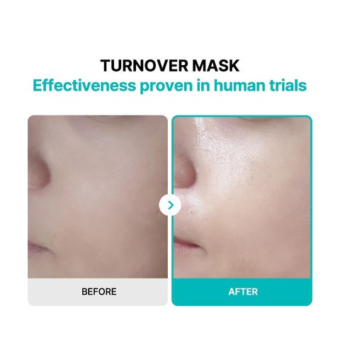 JuzBeauty-JuzBeautyMalaysia-JuzPretty-Authentic-Kbeauty-Malaysia-Skin-Care-Cosmetics-Jbeauty-Health-Care-korean-streetwear-Olive-Young-REJURAN Turnover Mask Healing Mask 水光再生修复面膜1