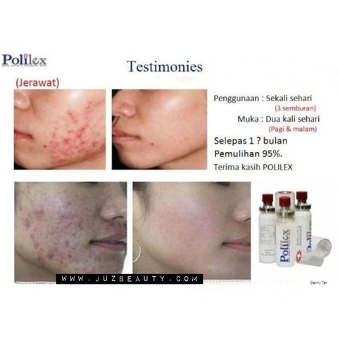 JuzBeauty-JuzBeautyMalaysia-JuzPretty-Authentic-Kbeauty-Malaysia-Skin-Care-Cosmetics-Jbeauty-Health-Care-korean-streetwear-Polilex Spray 喷雾8