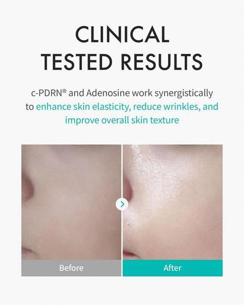 JuzBeauty-JuzBeautyMalaysia-JuzPretty-Authentic-Kbeauty-Malaysia-Skin-Care-Cosmetics-Jbeauty-Health-Care-korean-streetwear-AESTURA Rejuran Trueskin Mask 三文鱼黑面膜6