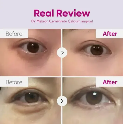 JuzBeauty-JuzBeautyMalaysia-JuzPretty-Authentic-Kbeauty-Malaysia-Skin-Care-Cosmetics-Jbeauty-Health-Care-korean-streetwear-Dr Melaxin Eyephalt 眼袋隐形霜18