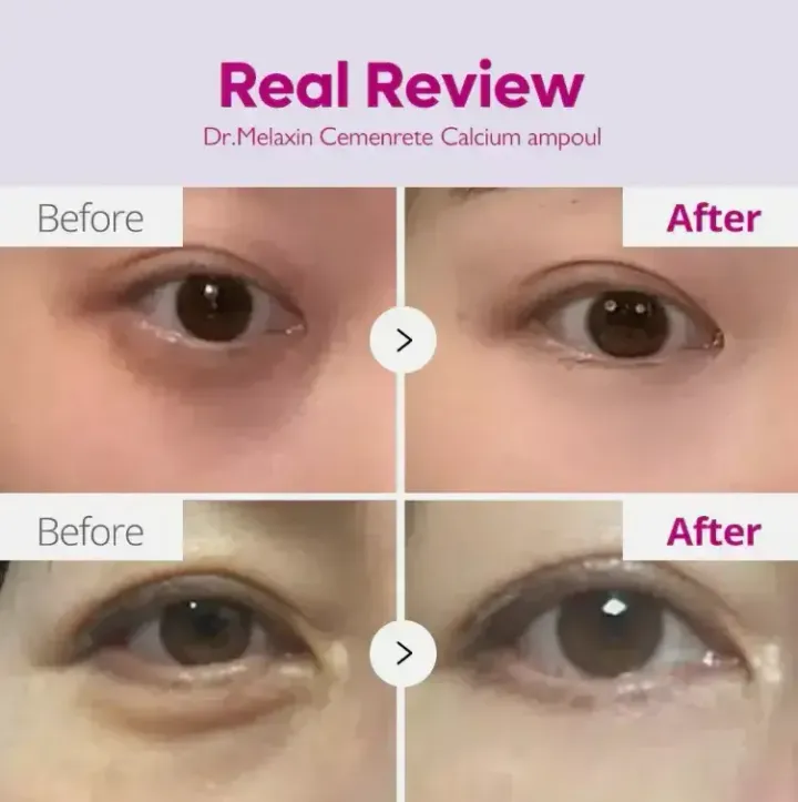 JuzBeauty-JuzBeautyMalaysia-JuzPretty-Authentic-Kbeauty-Malaysia-Skin-Care-Cosmetics-Jbeauty-Health-Care-korean-streetwear-Dr Melaxin Eyephalt 眼袋隐形霜18