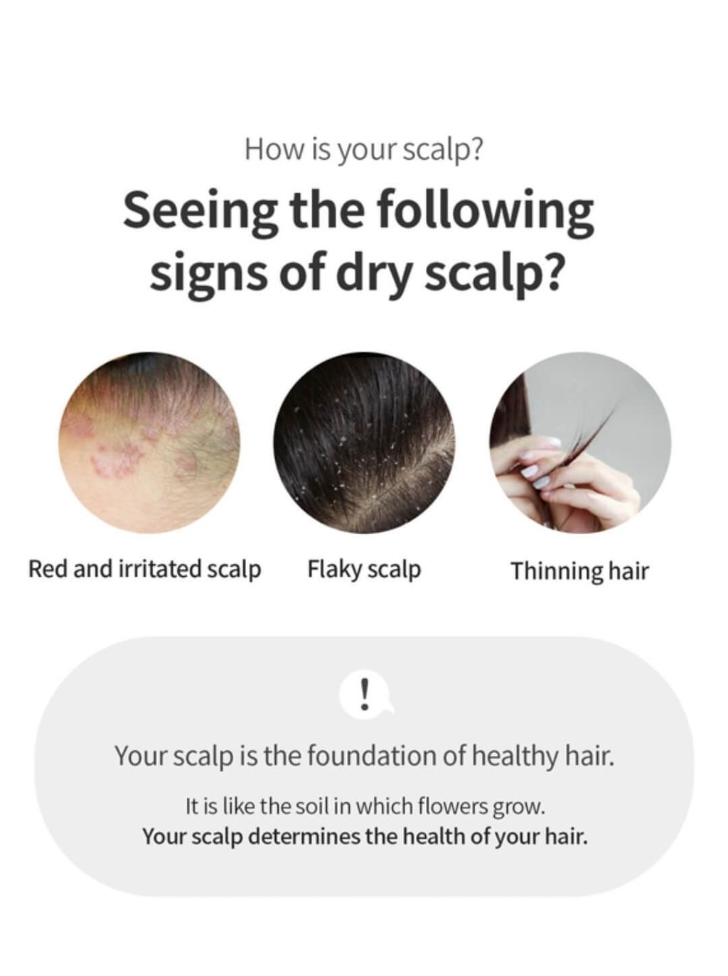 JuzBeauty-JuzBeautyMalaysia-JuzPretty-Authentic-Kbeauty-Malaysia-Skin-Care-Cosmetics-Jbeauty-Health-Care-korean-streetwear-GROWUS Damage Therapy Scalp Scaling Ampoule 头皮修复精华16