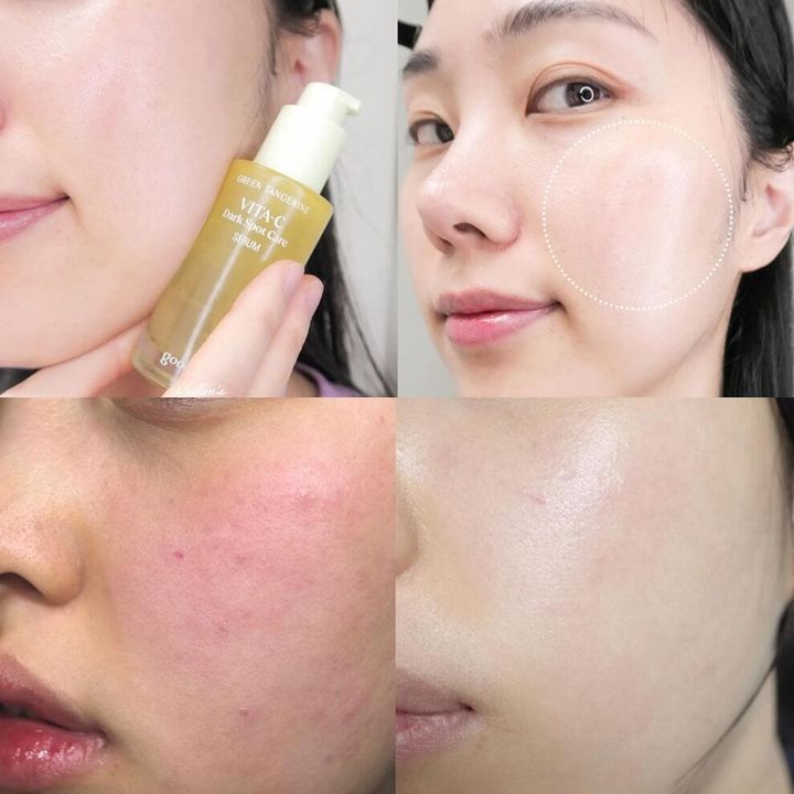 JuzBeauty-JuzBeautyMalaysia-JuzPretty-Authentic-Kbeauty-Malaysia-Skin-Care-Cosmetics-Jbeauty-Health-Care-korean-streetwear-Olive-Young-GOODAL x Munjakgwi Green Tangerine Vita-C Spot Care Serum 济州青橘VC淡斑精华3