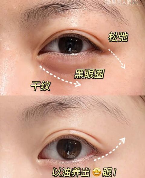 JuzBeauty-JuzBeautyMalaysia-JuzPretty-Authentic-Kbeauty-Malaysia-Skin-Care-Cosmetics-Jbeauty-Health-Care-korean-streetwear-Hexkin Camellia Concentrate Eye Oil 山茶花眼油 6