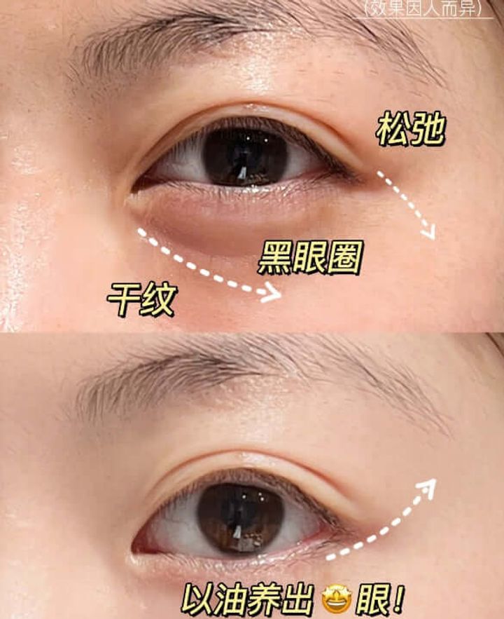 JuzBeauty-JuzBeautyMalaysia-JuzPretty-Authentic-Kbeauty-Malaysia-Skin-Care-Cosmetics-Jbeauty-Health-Care-korean-streetwear-Hexkin Camellia Concentrate Eye Oil 山茶花眼油 6