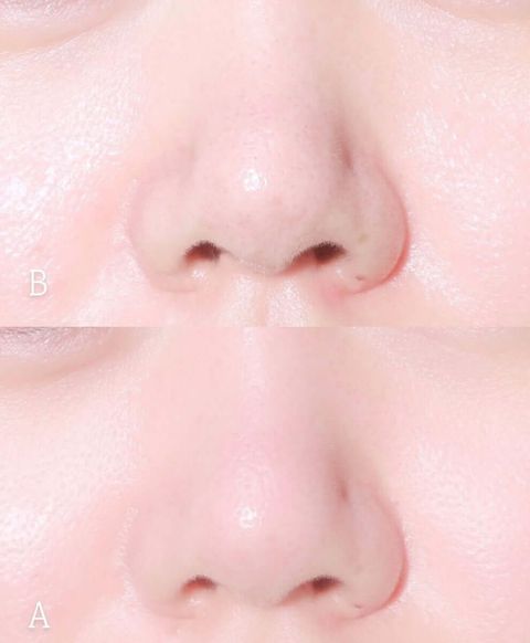 JuzBeauty-JuzBeautyMalaysia-JuzPretty-Authentic-Kbeauty-Malaysia-Skin-Care-Cosmetics-Jbeauty-Health-Care-korean-streetwear-Olive-Young-ilso Dual Cooling Master 冷敷仪 双头冰镇紧致按摩仪27