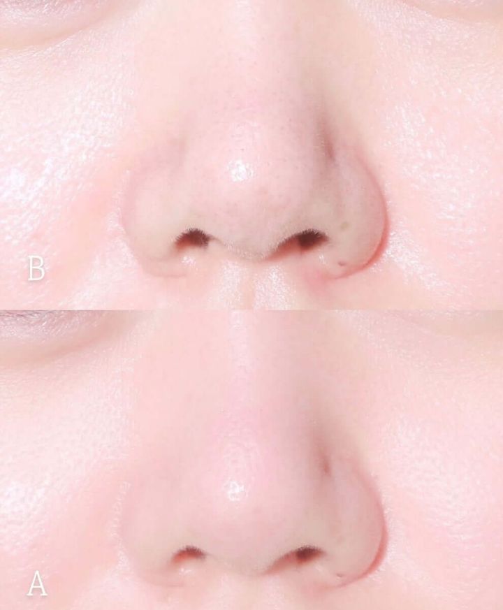 JuzBeauty-JuzBeautyMalaysia-JuzPretty-Authentic-Kbeauty-Malaysia-Skin-Care-Cosmetics-Jbeauty-Health-Care-korean-streetwear-Olive-Young-ilso Dual Cooling Master 冷敷仪 双头冰镇紧致按摩仪27