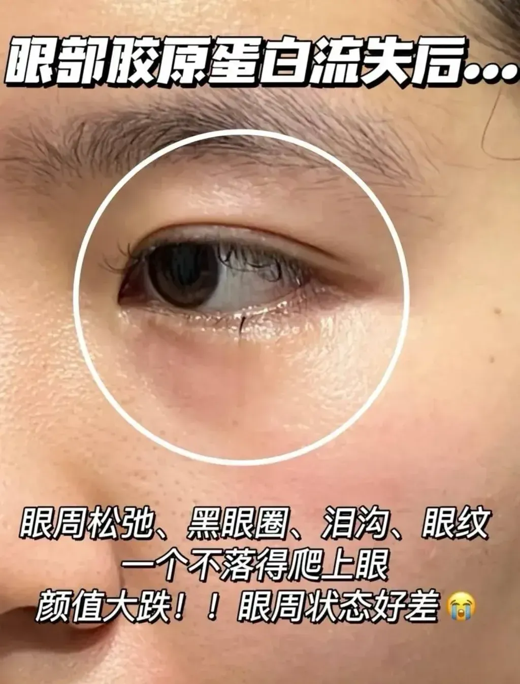JuzBeauty-JuzBeautyMalaysia-JuzPretty-Authentic-Kbeauty-Malaysia-Skin-Care-Cosmetics-Jbeauty-Health-Care-korean-streetwear-HEXKIN Extractive Brightening Peptide Eye Mask 赫诗琴臻萃焕颜肽眼膜3