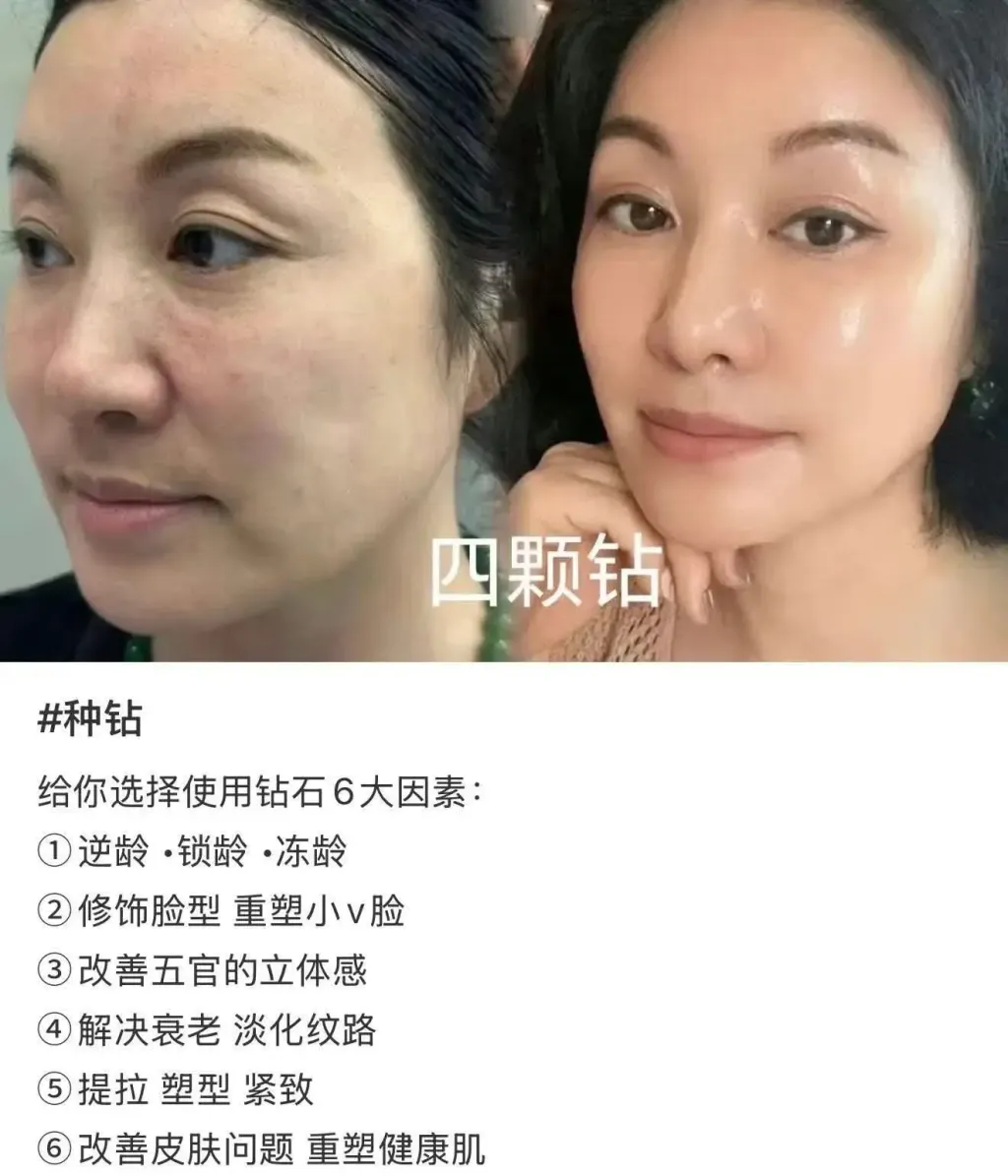 JuzBeauty-JuzBeautyMalaysia-JuzPretty-Authentic-Kbeauty-Malaysia-Skin-Care-Cosmetics-Jbeauty-Health-Care-korean-streetwear-NUDIQUE Dia Spithera Ampoule 钻石微针胶原蛋白精华5