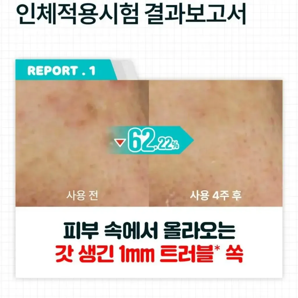 JuzBeauty-JuzBeautyMalaysia-JuzPretty-Authentic-Kbeauty-Malaysia-Skin-Care-Cosmetics-Jbeauty-Health-Care-korean-streetwear-numbuzin x Pochacco No 1 Pantothenic B5 Active Soothing Serum Refill Set 泛酸B5活性舒缓精华套盒7