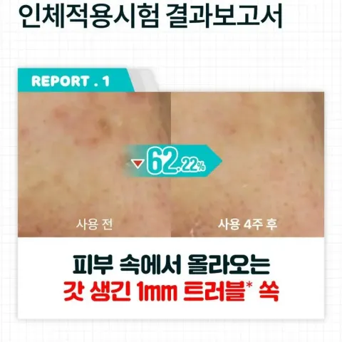 JuzBeauty-JuzBeautyMalaysia-JuzPretty-Authentic-Kbeauty-Malaysia-Skin-Care-Cosmetics-Jbeauty-Health-Care-korean-streetwear-numbuzin x Pochacco No 1 Pantothenic B5 Active Soothing Serum Refill Set 泛酸B5活性舒缓精华套盒7