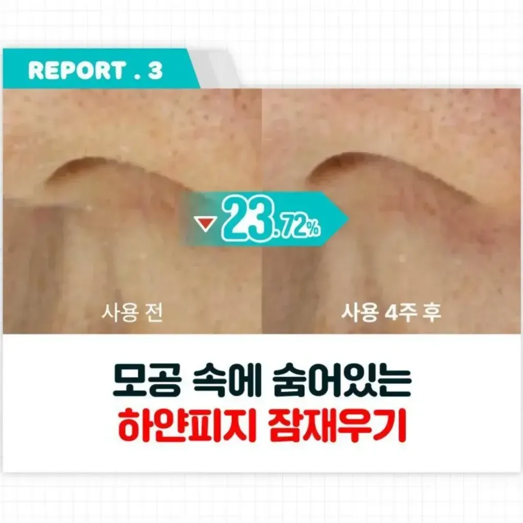 JuzBeauty-JuzBeautyMalaysia-JuzPretty-Authentic-Kbeauty-Malaysia-Skin-Care-Cosmetics-Jbeauty-Health-Care-korean-streetwear-numbuzin x Pochacco No 1 Pantothenic B5 Active Soothing Serum Refill Set 泛酸B5活性舒缓精华套盒5