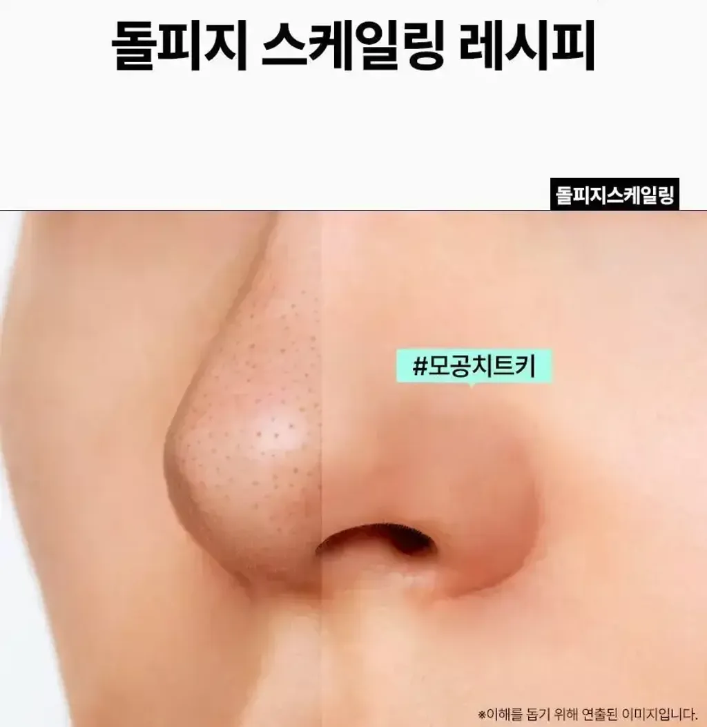 JuzBeauty-JuzBeautyMalaysia-JuzPretty-Authentic-Kbeauty-Malaysia-Skin-Care-Cosmetics-Jbeauty-Health-Care-korean-streetwear-Olive Young ILSO Deep Clean Master 不锈钢深清刮刮黑头铲3