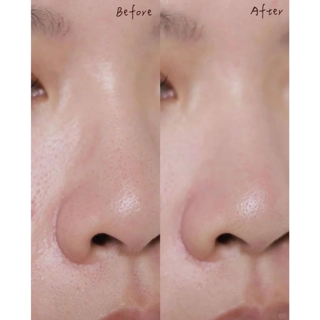 JuzBeauty-JuzBeautyMalaysia-JuzPretty-Authentic-Kbeauty-Malaysia-Skin-Care-Cosmetics-Jbeauty-Health-Care-korean-streetwear-Olive Young ILSO Deep Clean Master 不锈钢深清刮刮黑头铲9