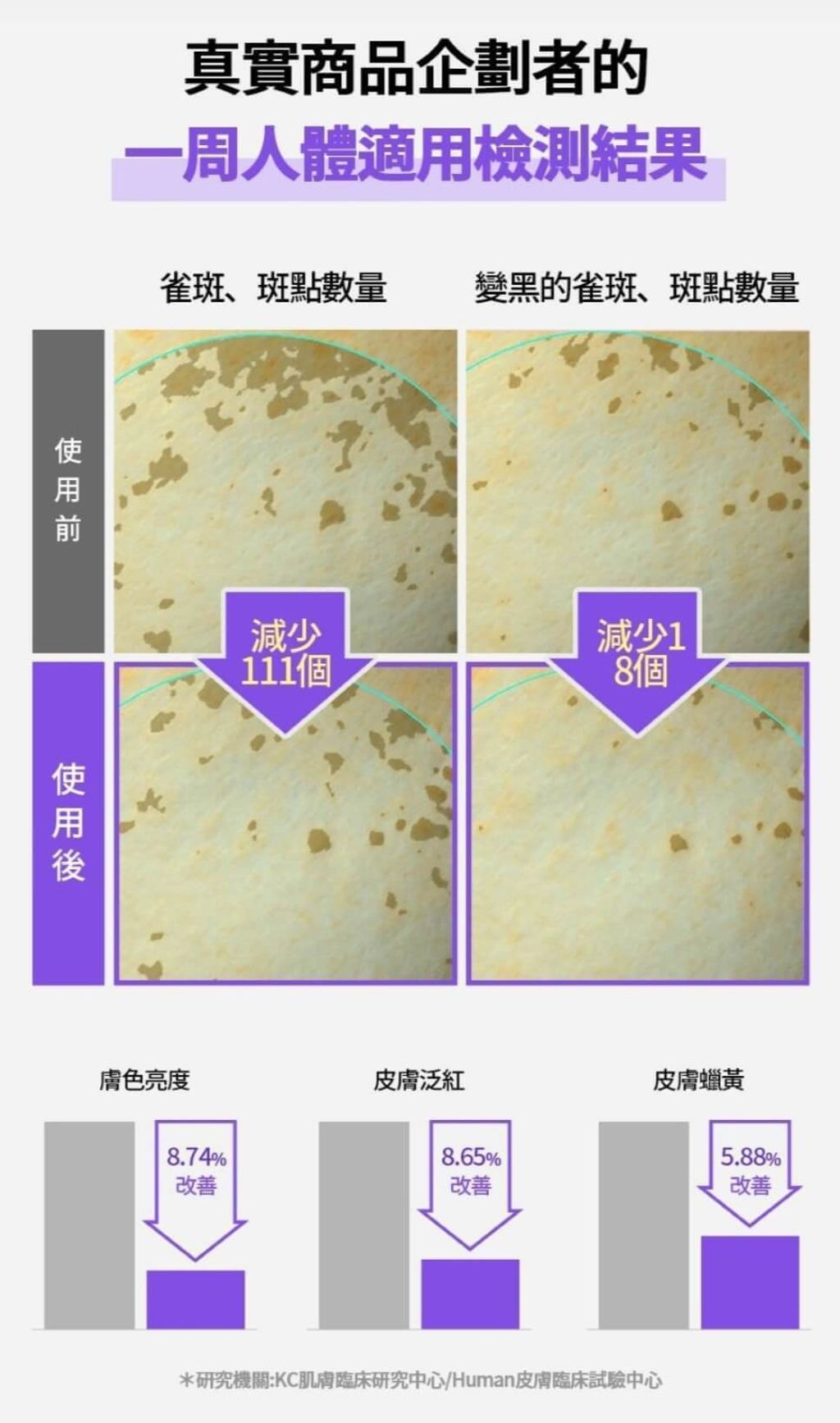 JuzBeauty-JuzBeautyMalaysia-JuzPretty-Authentic-Kbeauty-Malaysia-Skin-Care-Cosmetics-Jbeauty-Health-Care-korean-streetwear-olive-young-SUNGBOON EDITOR Meoru Podo Vita C Dark Spot Ampoule Set 山葡萄维C淡斑精华套盒4