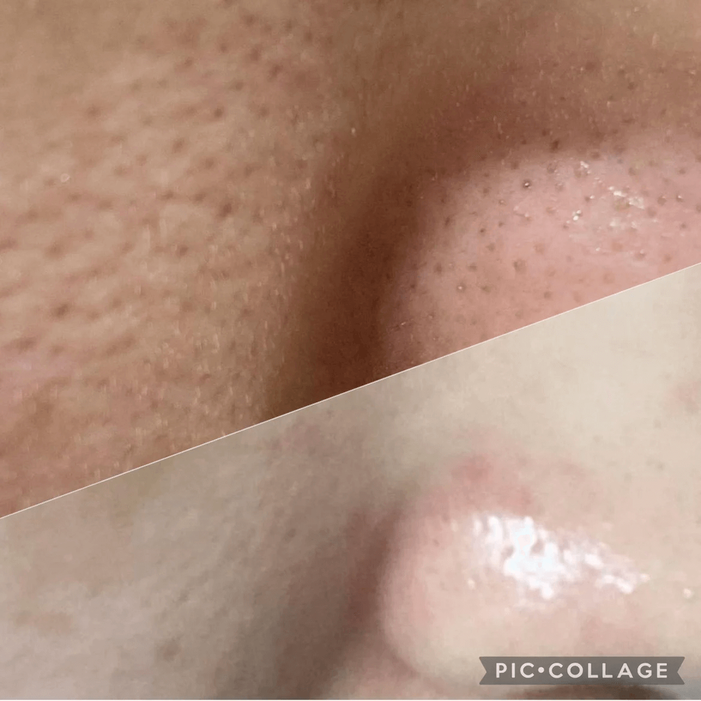 JuzBeauty-JuzBeautyMalaysia-JuzPretty-Authentic-Kbeauty-Malaysia-Skin-Care-Cosmetics-Jbeauty-Health-Care-korean-streetwear-SUNGBOON EDITOR Green Tomato Pore Lifting Ampoule 绿番茄紧致毛孔精华11