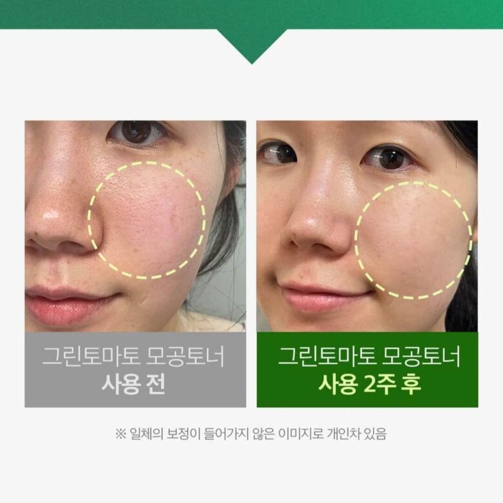 JuzBeauty-JuzBeautyMalaysia-JuzPretty-Authentic-Kbeauty-Malaysia-Skin-Care-Cosmetics-Jbeauty-Health-Care-korean-streetwear-Olive Young SUNGBOON EDITOR Green Tomato Pore Lifting Ampoule Toner 绿番茄零毛孔紧致爽肤水9