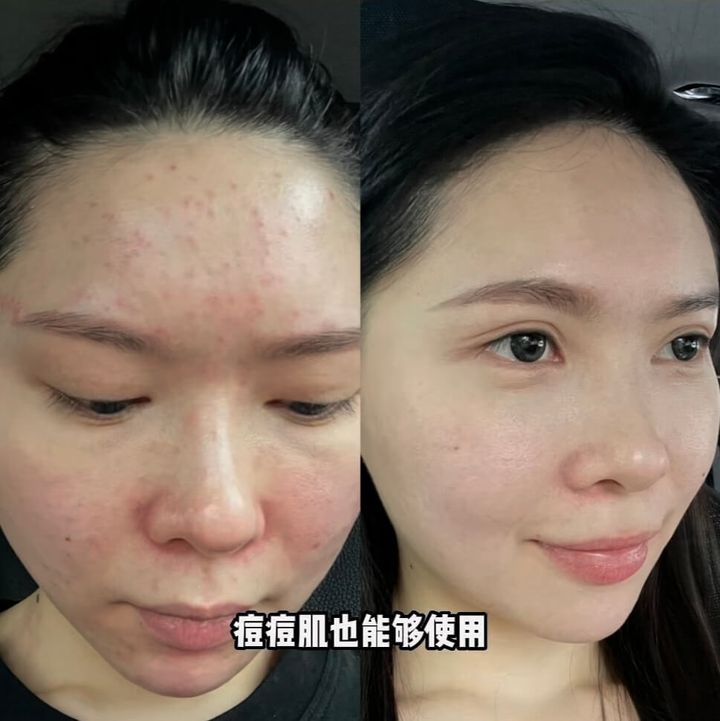 JuzBeauty-JuzBeautyMalaysia-JuzPretty-Authentic-Kbeauty-Malaysia-Skin-Care-Cosmetics-Jbeauty-Health-Care-korean-streetwear-CELAVIVE Premium Pack 终极护肤配套4