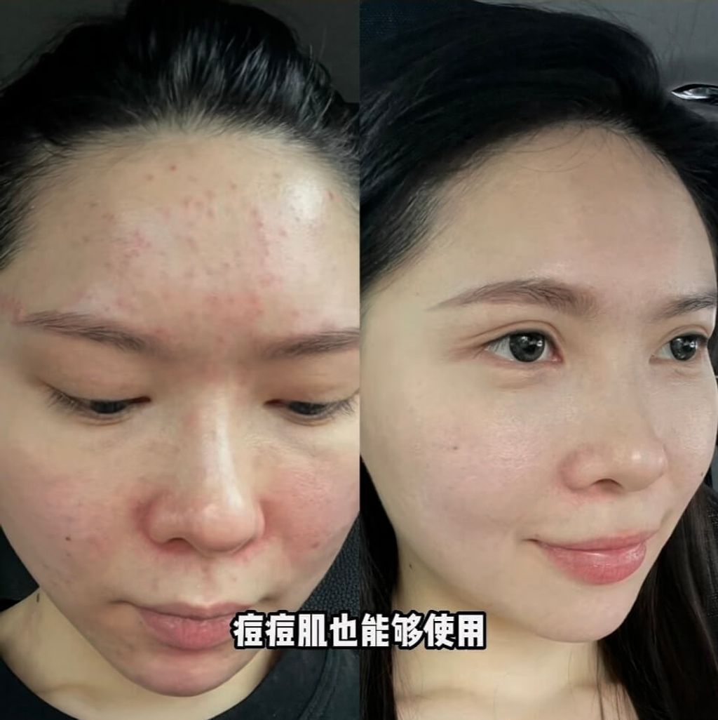 JuzBeauty-JuzBeautyMalaysia-JuzPretty-Authentic-Kbeauty-Malaysia-Skin-Care-Cosmetics-Jbeauty-Health-Care-korean-streetwear-CELAVIVE Premium Pack 终极护肤配套4