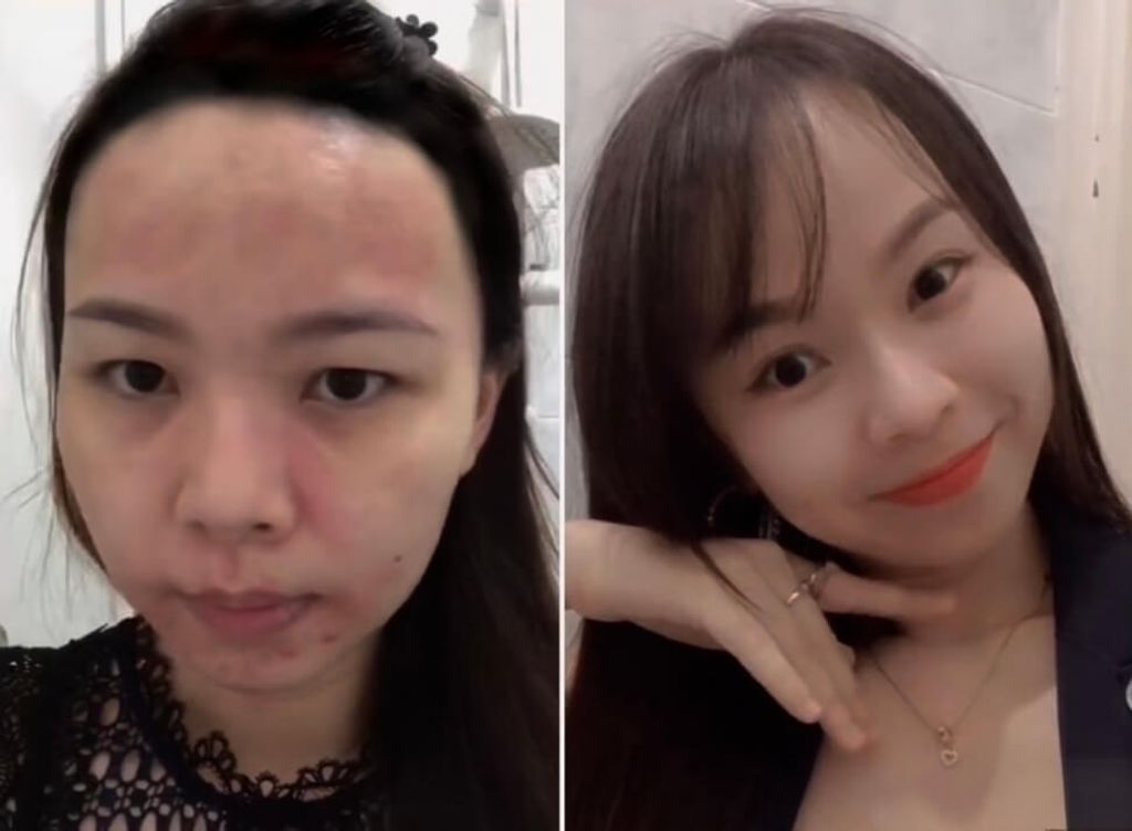 JuzBeauty-JuzBeautyMalaysia-JuzPretty-Authentic-Kbeauty-Malaysia-Skin-Care-Cosmetics-Jbeauty-Health-Care-korean-streetwear-CELAVIVE Premium Pack 终极护肤配套2